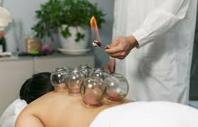Hijama